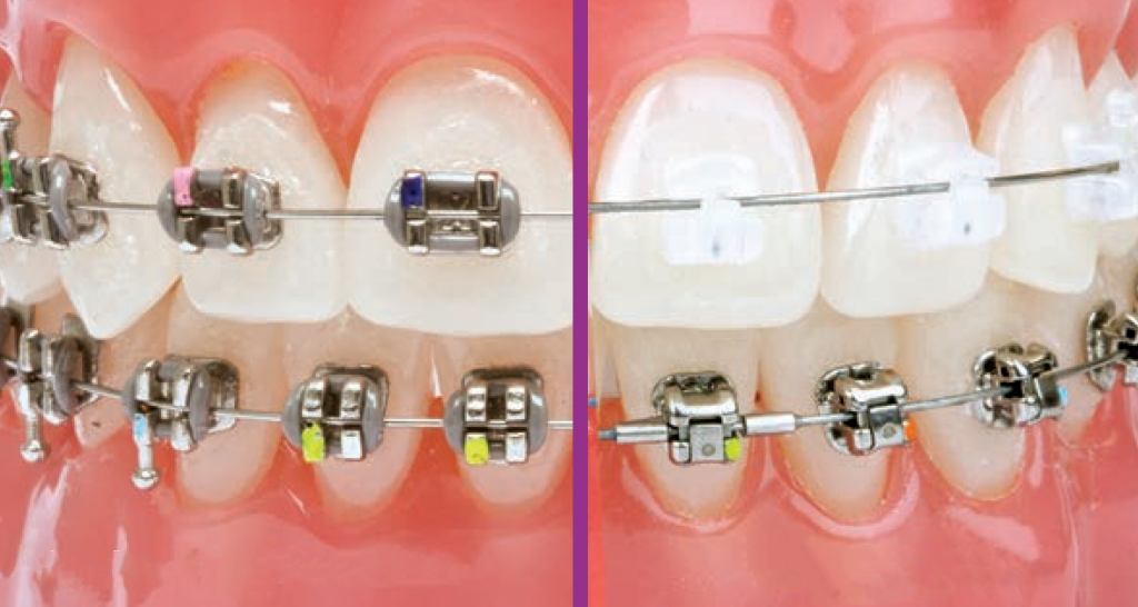 Clinica DYS Dental - Sistema Damon